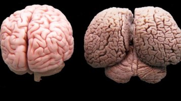 왼쪽은 사람의 뇌, 오른쪽은 돌고래의 뇌