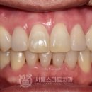 라인교정치과기공소 이미지