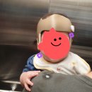 6개월 아기 사두 두상교정헬멧 상담/피팅 후기👷‍♂️(강남세브란스 성형외과, 아이러브밴드)
