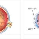 안압이 높으면, 높아지는 이유와 낮추는 방법을 알아보자 이미지