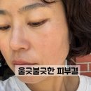 뉴-스킨동안피부샵