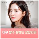 대구 쌍수 잘하는 곳 성형외과 후기 좋은 이유