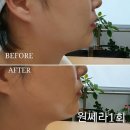 구미형곡동 피부관리실 태리윤뷰티토탈샵 민감성피부관리 전문