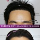 모앤라인성형외과의원 네이버블로그