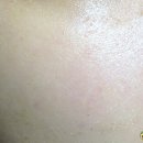 엘에이치바이오 이미지