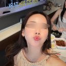 오푸스 | 청담피부과 통증없는 오푸스레이저 리프팅 후기