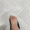 선운우리정형외과의원 네이버블로그