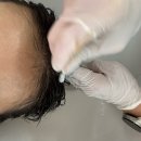 지에스25익산수도산점 | 익산 헤드스파 디어마인에서 두피관리 받은 후기