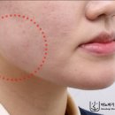이지웰레드치과의원 | 안면 비대칭 교정 후기 알아보신다면