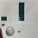 비바의원 | 아기 사두 단두 두상교정 비바3D헬멧 상담 솔직후기