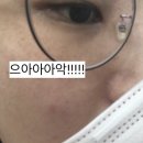 하얀나라김피부과 네이버블로그