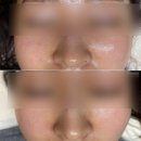 [멜리 언스 진동클렌저]내돈내산 한 달 사용기