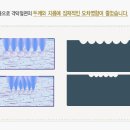 [┖인트라] [라식 / 라식수술] 인트라라식 그 우수성에 대하여 이미지