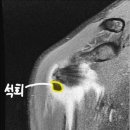 뉴수도정형외과의원 티스토리