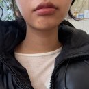 드네의원 | 리프팅 / 웨촬·본식 일주일 전 관리 추천 / 목 가로주름·미백·토닝·색소침착·흉터 고민 / 드네의원