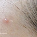 오일스팟 이미지