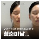 청춘관리 - 전주시 완산구 | 청주 복대동 피부관리 '청춘미남' 시그니처 작은얼굴 윤곽관리 솔직 후기
