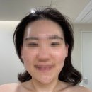 로에스파 | 군자역 작은 얼굴 윤곽 관리 받은 후기! 장안동 피부 관리 로에스파