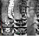 Pressed dr 이미지