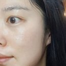 하나비젼실버홈 | 광채 셀프피부관리 아지크 스킨 리셋 실버박스 홈스테틱