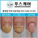 푸스케어바르고운네일