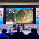 엔도웨이 이미지