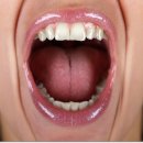 하나어린이치과의원 네이버블로그