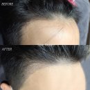 영수헤어라인
