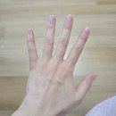 아이엠요양병원 | 구미 미리안산부인과 5일차6일차 퇴원후기