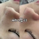 모던케어 | 블랙헤드 고민 끝 부천 상동 모공 피부관리 전문 써니뷰티 그린 필오프팩 관리 후기