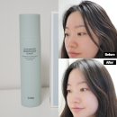 아쿠아헤어 | 데일리 두피관리 솔랩 헤어루트 아쿠아 픽 두피 스케일러 후기