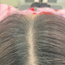 퀸헤어샵 | 대구 수성구 두피관리 모발퀸 후기｜탈모관리 + 윤곽관리 효과 솔직후기