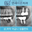 연세바른치과의원 이미지