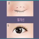 셀럽성형외과의원 이미지