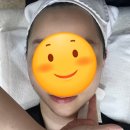 월평동-2 | 대전 월평동 호야뷰티 뼈턱 리프팅 받고 온 후기 2탄~!