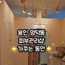 림프앤동안