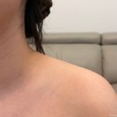 디아존 | 승모근 괄사마사지 방법 떼르디아로망 BB괄사 다이어트 키트 사용후기
