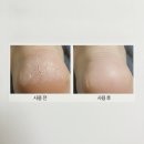 메디필 | 메디필 풋크림 솔직 후기 지긋지긋한 발각질 탈출