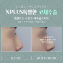 압구정앤성형외과의원 이미지