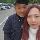 [ 갑상선 안병증 치료 / 뮐러근 재수술 후기] 신촌세브란스 그레이브스, 안병증 눈돌출 치료기록