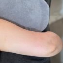 씨유 마석라온1단지점 | 마석 다이어트 예비신부 팔뚝살 관리 셀라피(고주파) 관리 ‘스키니바디’ 후기