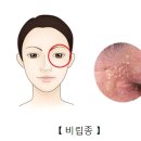 작은인 이미지