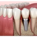 잘씹는치과의원 이미지