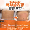 문미선토탈뷰티센터 | 서면 바디관리 추천 이브뷰티센터 복부슬리밍 솔직후기