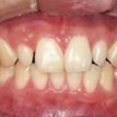 정원치과기공소 이미지