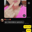 사상튼튼정형외과의원 | 엄마의 어깨통증 석회성견염 사상튼튼정형외과에서 치료받고 사상헬스장에서 운동