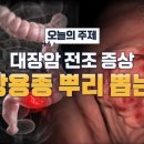 대장암 전조증상! 대장용종 뿌리 뽑는 법 이미지