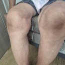 세종복지용구 티스토리