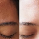 포이즌의원 이미지