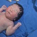제인병원 | 분당제일여성병원 제왕절개 후기 1일차(오전 9시 수술, 1인실 후기, 수술 후 타임라인 등)